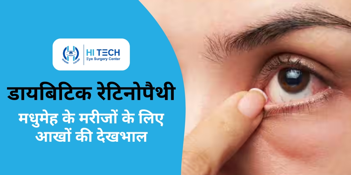 मधुमेह के मरीजों के लिए आखों की देखभाल