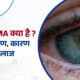 Glaucoma क्या है ? इसके लक्षण, कारण और इलाज 