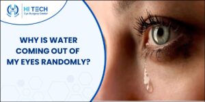 Why is water coming out of my eyes randomly? | Hi Tech Eye Surgery Center
