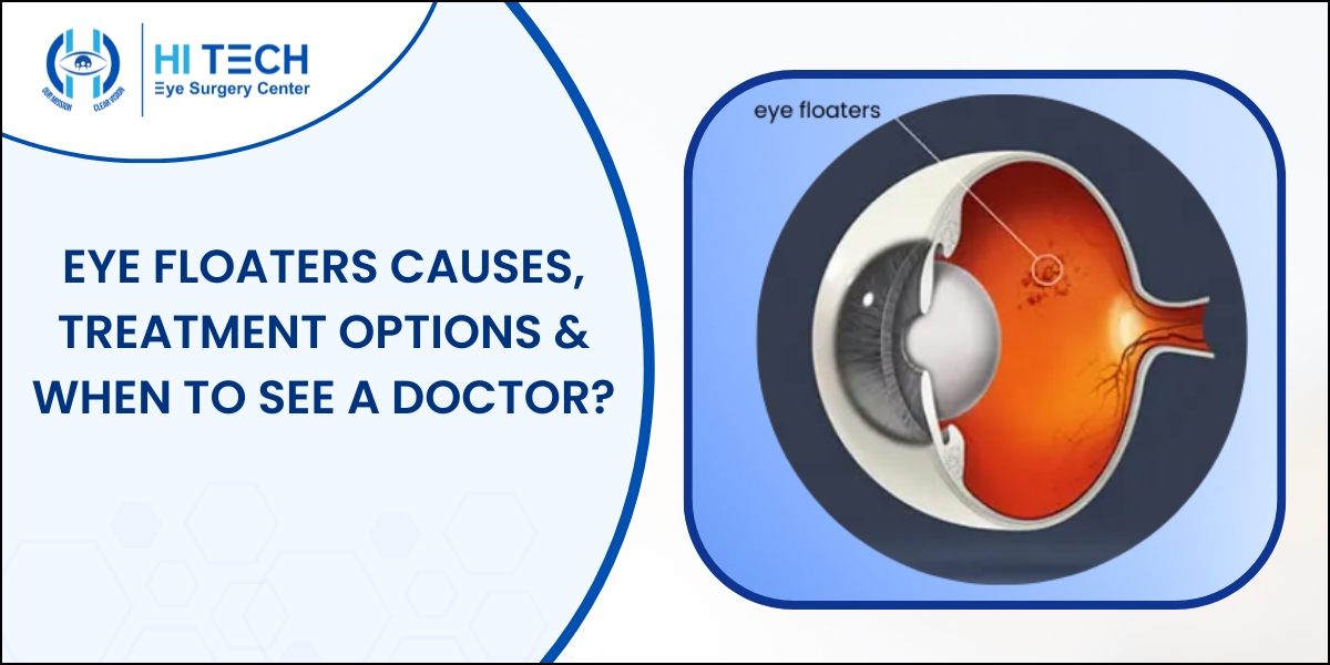 Eye Floaters - Causes and Treatment Options
