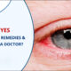 Red Eyes Red Eyes - Causes and Symptoms