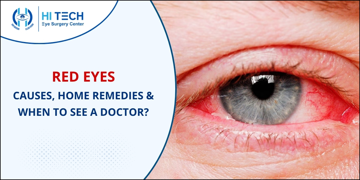 Red Eyes - Causes and Symptoms