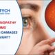 Diabetic Retinopathy Treatment Pune
