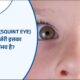 Squint Eye in Children बच्चों में भेंगापन : क्या बिना सर्जरी के इसका इलाज संभव है?