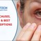 Dry Eyes Dry Eyes: Causes and Symptoms
