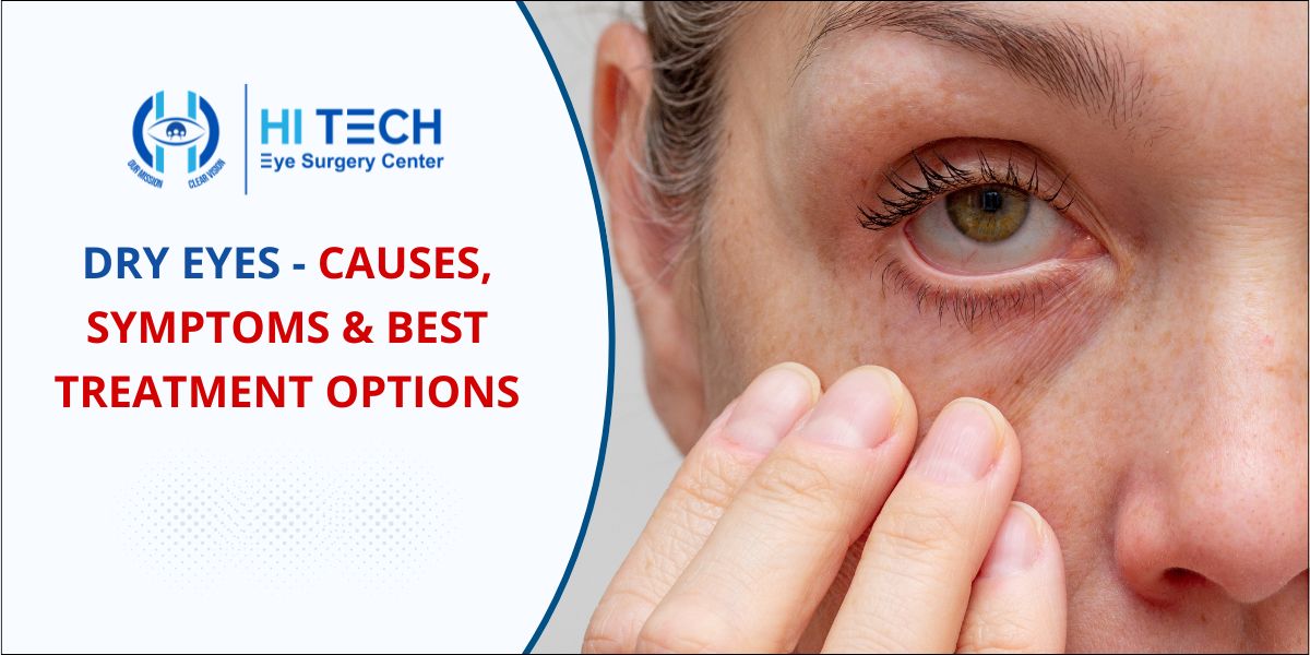 Dry Eyes: Causes and Symptoms