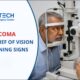 Glaucoma: The Silent Thief of Vision – Early Warning Signs
