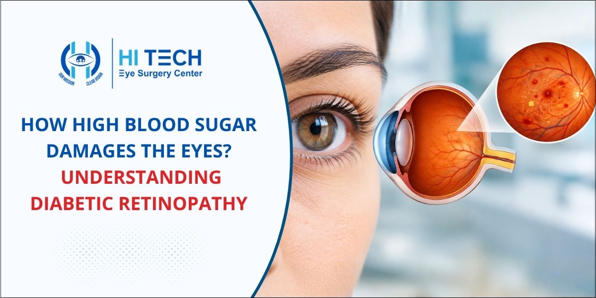 Understanding Diabetic Retinopathy