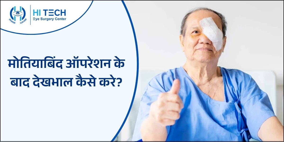 मोतियाबिंद ऑपरेशन के बाद देखभाल कैसे करे
