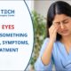 Itchy Eyes Treatment in Pune