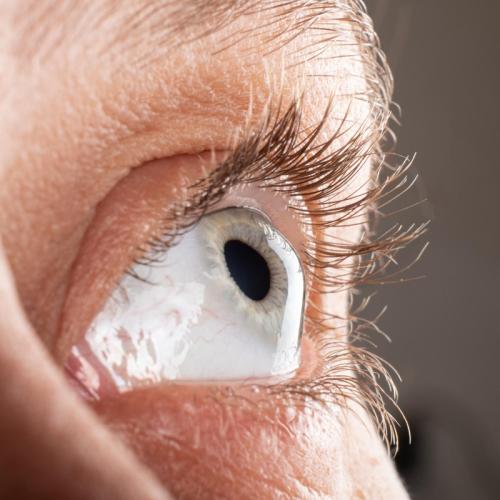 Cornea Transplant Treatment in Undri, Pune