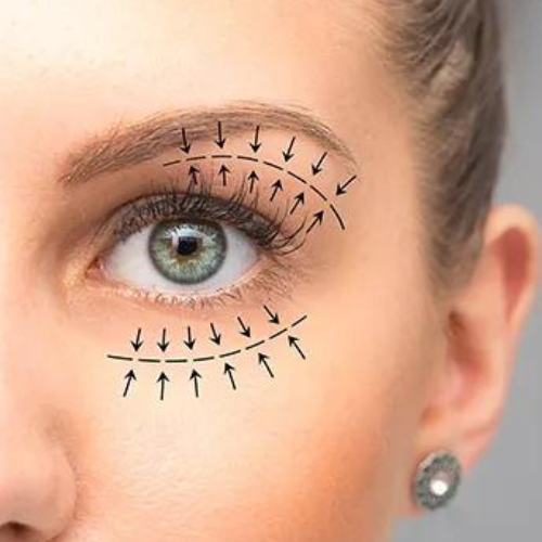 Oculoplastic Surgery